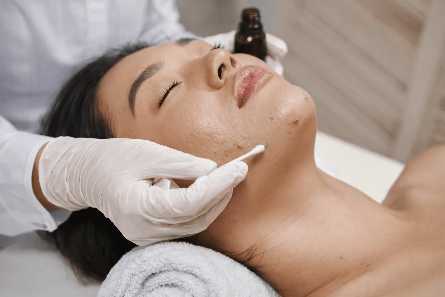 Facial anti-acné